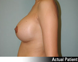 Patient # 16579 After Photo # 6