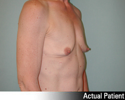 Patient # 15652 Before Photo # 3