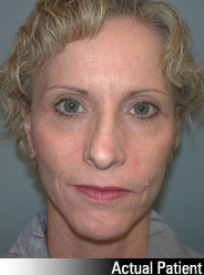 Patient # 54906 After Photo # 2