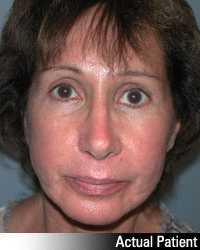 Patient # 66706 After Photo # 2