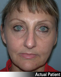 Patient # 98396 After Photo # 2