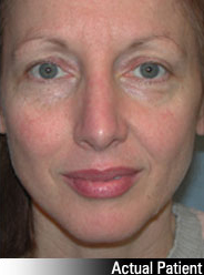 Patient # 21025 After Photo # 2