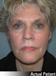 Patient # 39771 After Photo # 2