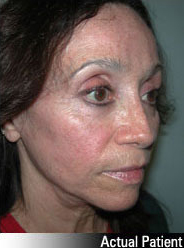 Patient # 57256 After Photo # 2