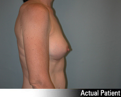 Patient # 15652 After Photo # 6