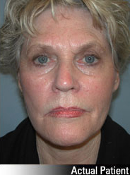 Patient # 48539 After Photo # 2