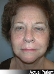 Patient # 49634 After Photo # 2