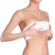 Breast reduction