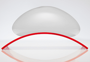 Breast Implants | Ideal Implant | San Jose CA | Los Gatos | Sunnyvale