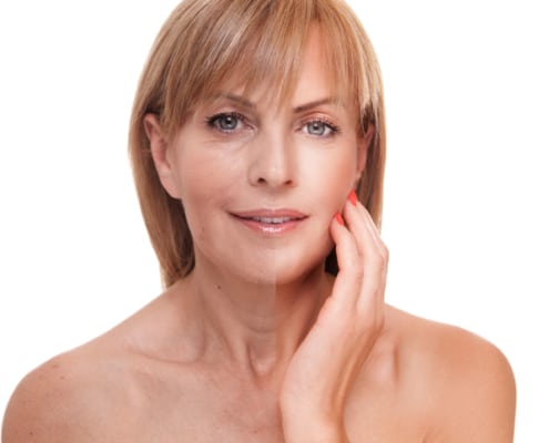 Facelift Surgery San Jose CA