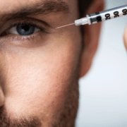 Man during surgery filling facial wrinkles